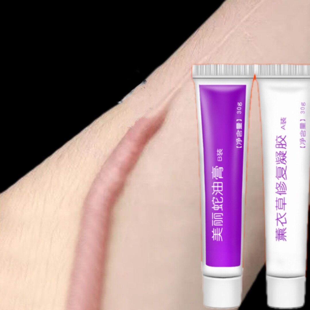 Gambar Scar removal cream Acne cream Remove stretch marks Remove acne marks Remove scars Remove scars Burns Falls Old wounds new wounds 30ml