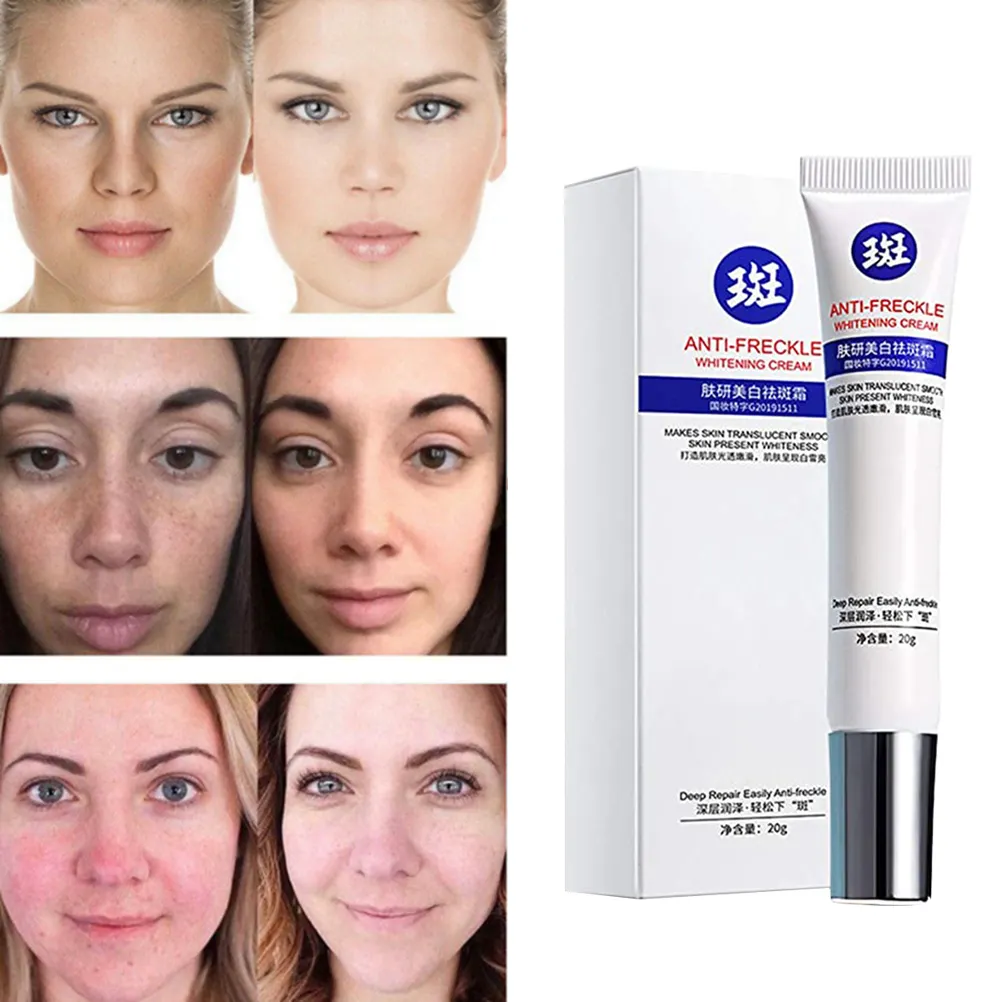 blemish whitening cream