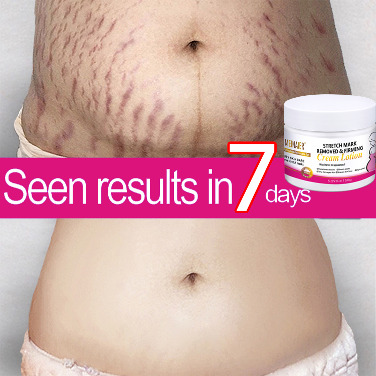 Buy Himalaya Gastric Ulcer Online at a Better Price Lazada Malaysia