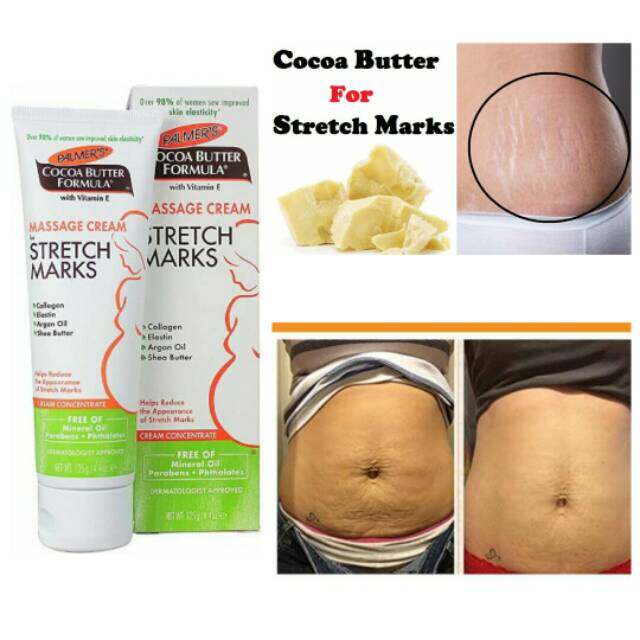 shea moisture stretch mark