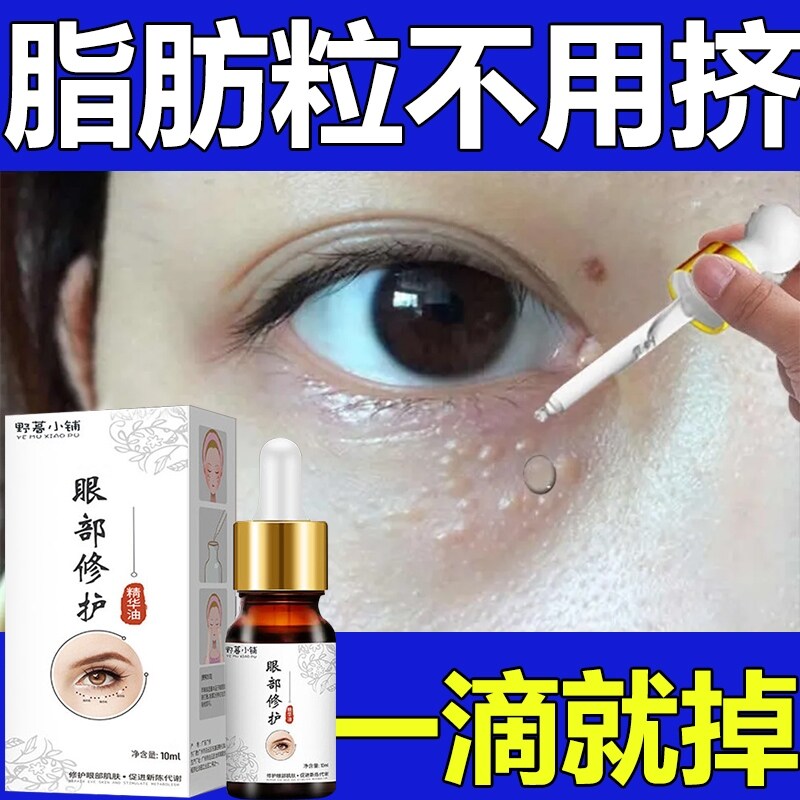 Gambar Syringoma fat particle removal artifact to dilute dark circles around the eyes oil particles eye essence men and women eye cream