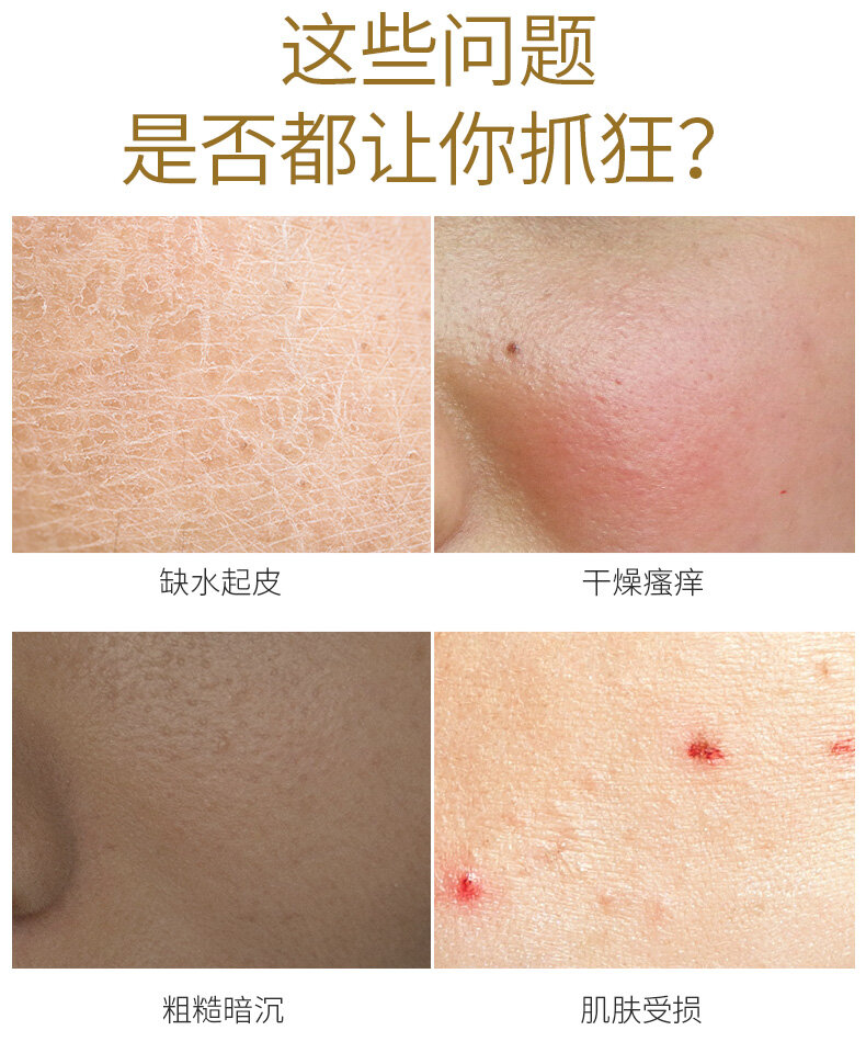 lucenbase b5 hyaluronic acid