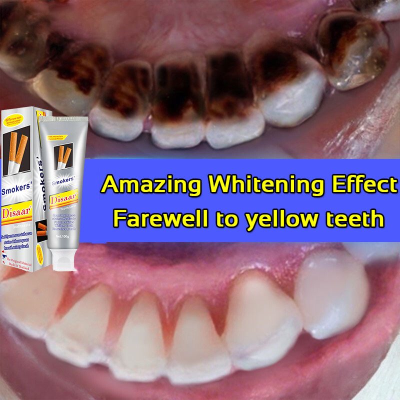 Gambar Teeth whitening Teeth stain remover pemutih gigi 100ml Oral care, clean teeth, quickly remove black and yellow teeth tea stains, apply all dirt, restore teeth color, safe, effective and fast