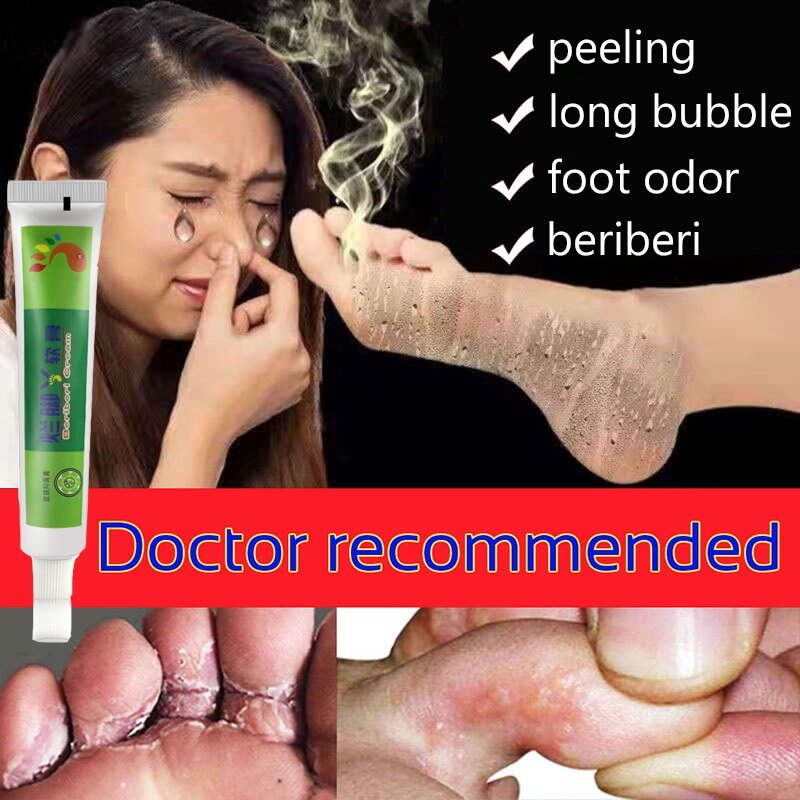 Gambar Beriberi cream foot care ointment Deodorant beriberi cream antibacterial foot cream quick acting foot cream antibacterial foot cream 25g