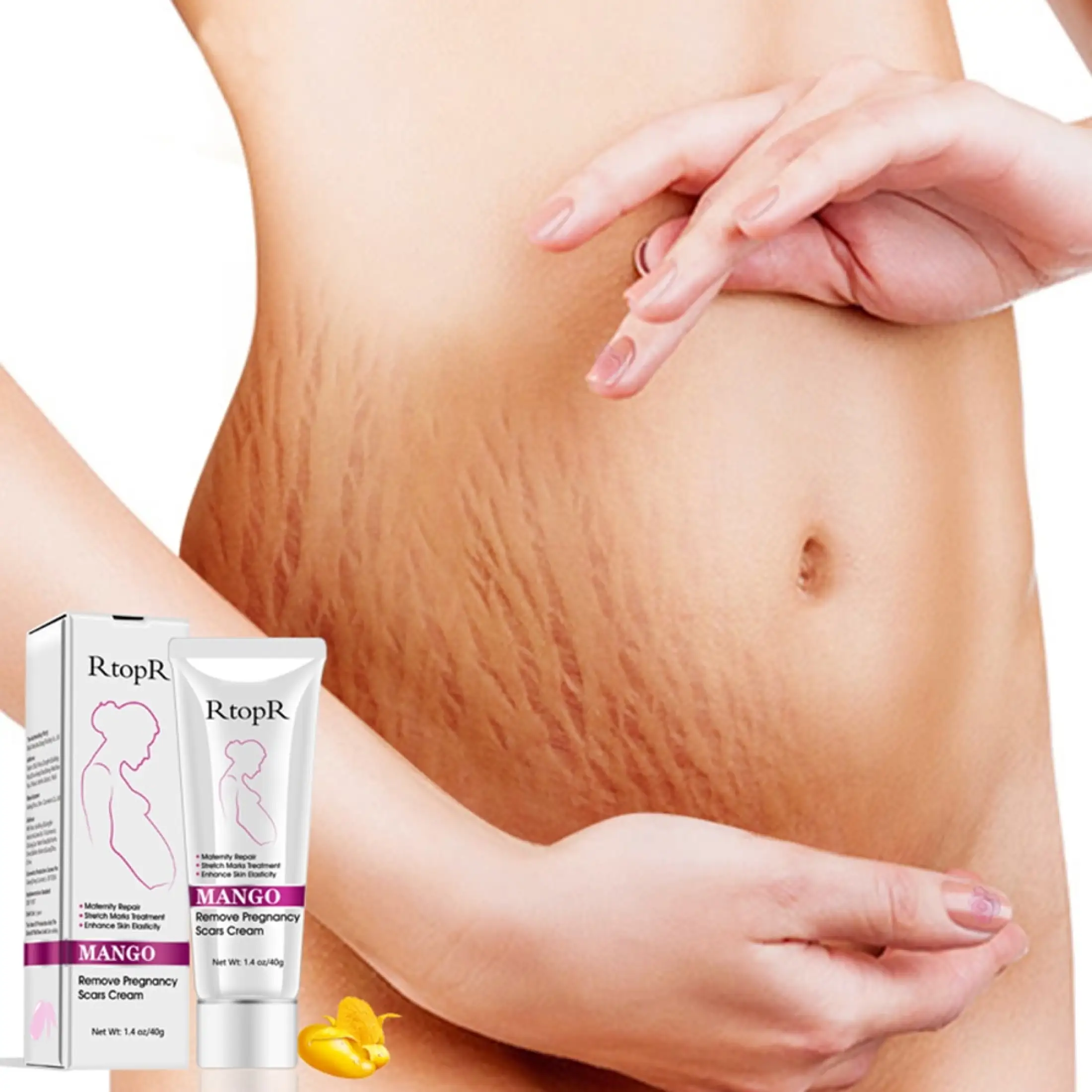 rtopr stretch mark cream