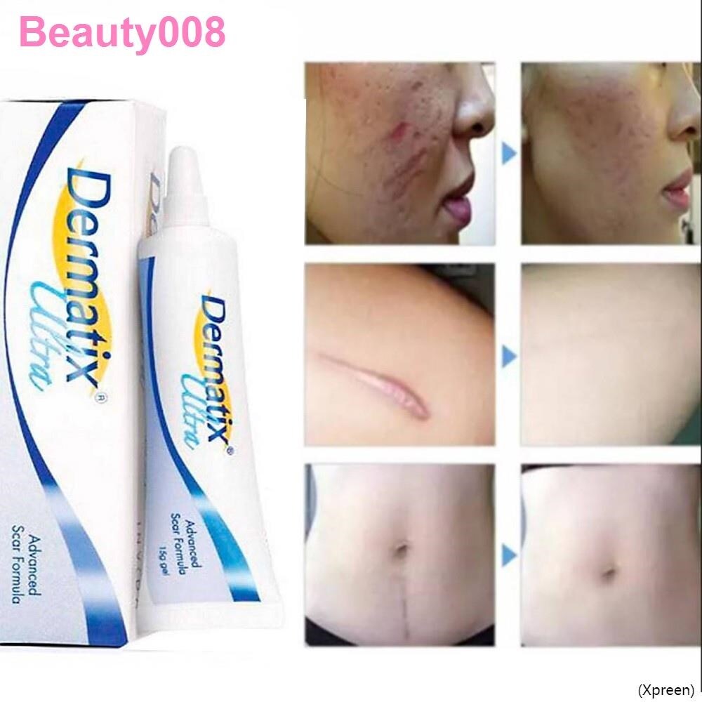 Gambar Australia dermatix scar silicone gel ointment double eyelid children scars caesarean section pimple bump repair hyperplasia scar cream