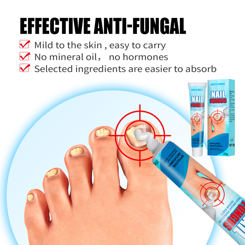 Nail Fungus Removal Cream Onychomycosis Fungal Nail Treatment