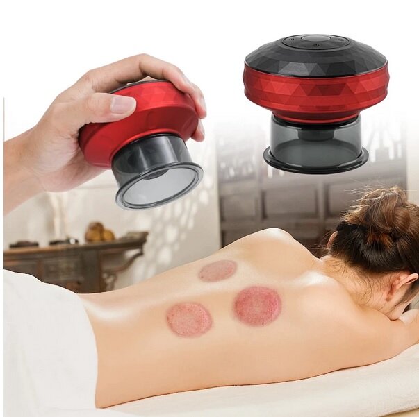 Cup Bekam Elektrik Pintar (Smart Electric Cupping Massage) Harga  159 Ringgit*Penghantaran Percuma