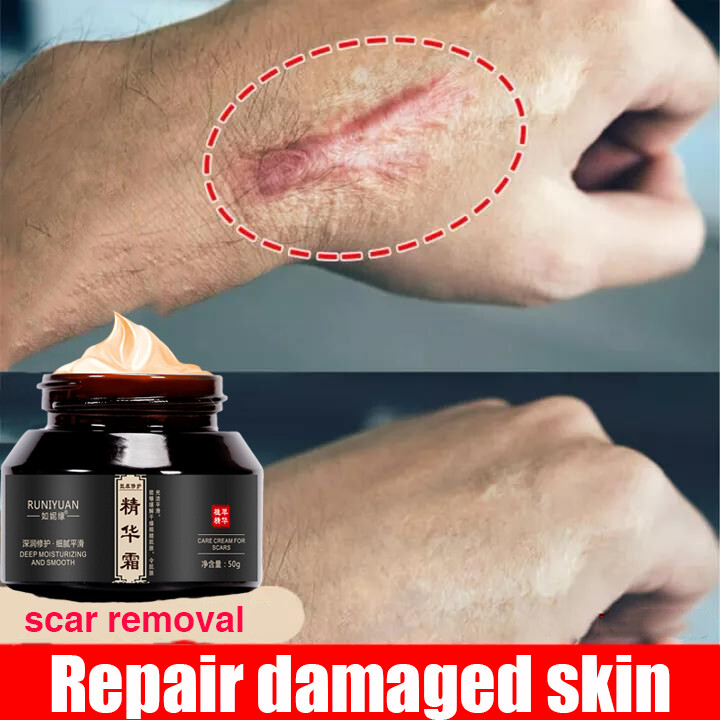 Gambar ?Malaysia local spot? Skin Repair Face Cream Krim Pembaikan Penghilang Stretch Mark Krim Jerawat Rawatan Penanda Parut Muka Minyak Kilat Mengawal Pori Mengecilkan Pelembap ?Eliminate obesity lines and growth lines?