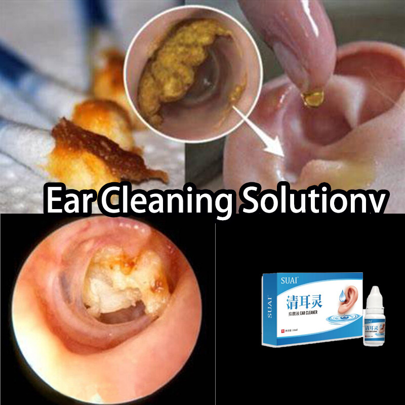 Gambar Ear Cleaning Solution Tinnitus Otitis  Ear Cleanser remove dirt earwax reduce tinnitus airplane tinnitus clear ear piercings ear spoon inaudible hearing loss