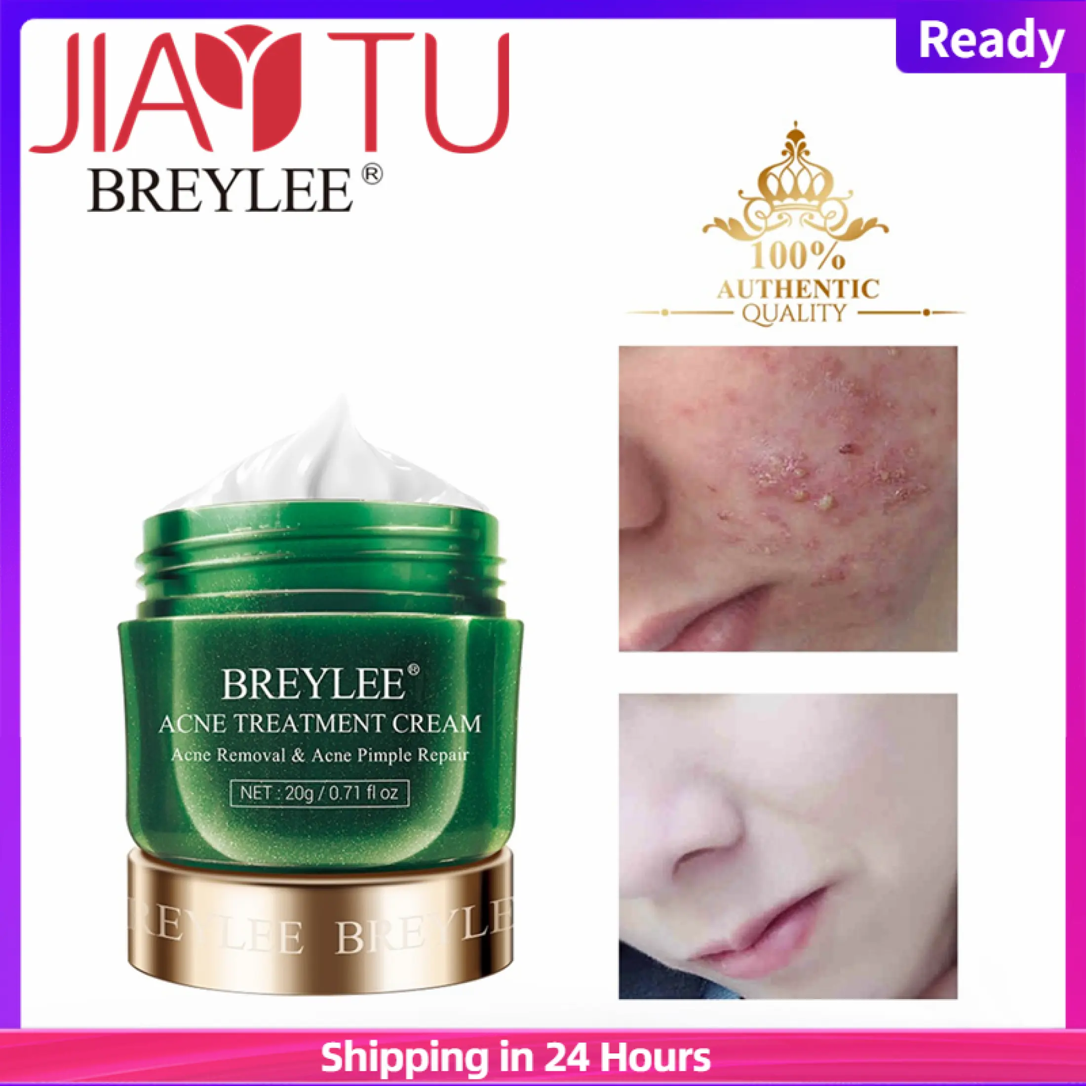 pores on face treatment cream