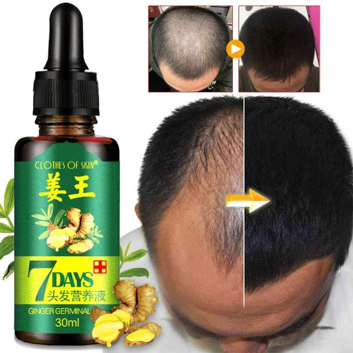 Gambar Ginger Germinal Hair Growth Hair Loss Essential Oil Treatment 30ml
