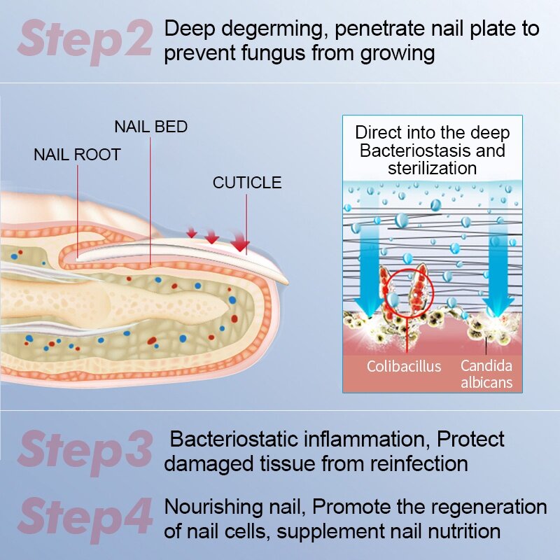 vibrant glamour dưỡng móng tay dài và cứng nail repair serum fungal nail treatment essence remove onychomycosis toe nourishing hand foot nail skin care 15ml 3