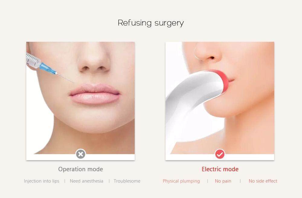Automatic Lip Plumper Electric Plumping Device Beauty Tool Fuller Bigger Thicker Lips for Women- Milk White