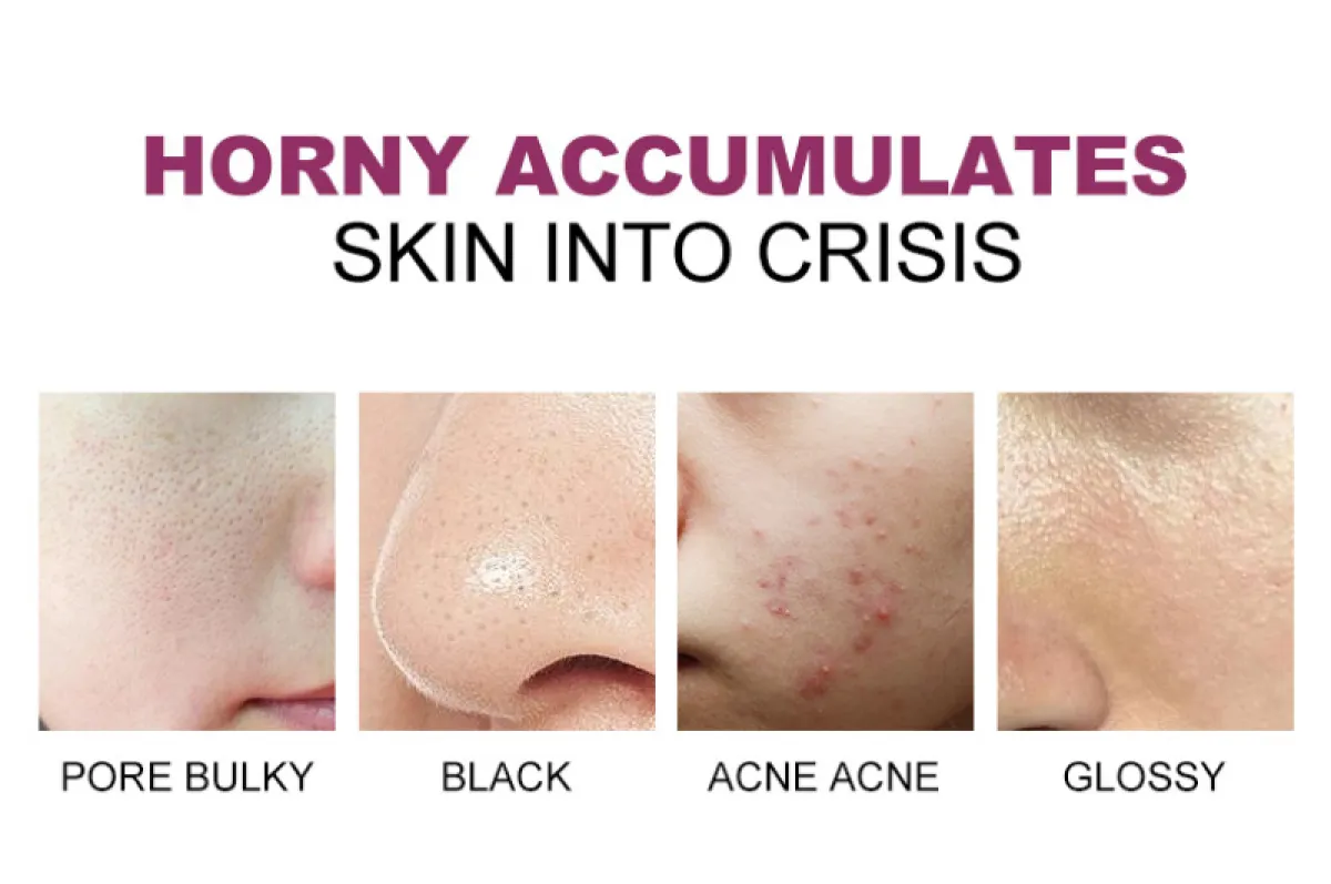 advanced milk exfoliation