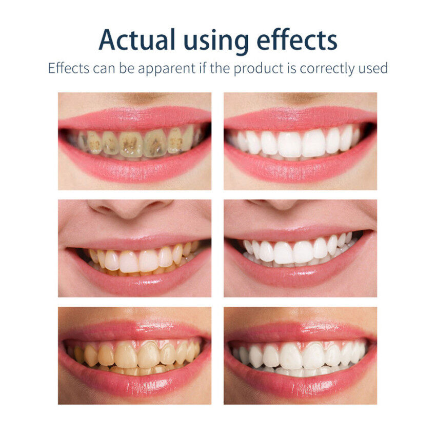 Bánh Mousse Trắng Răng BAIMISS Kem Đánh Răng Làm Sạch Răng Vệ Sinh Răng Miệng Tươi Sáng Loại Bỏ Mảng Bám Vết Bẩn Hôi Miệng Dụng Cụ Nha Khoa