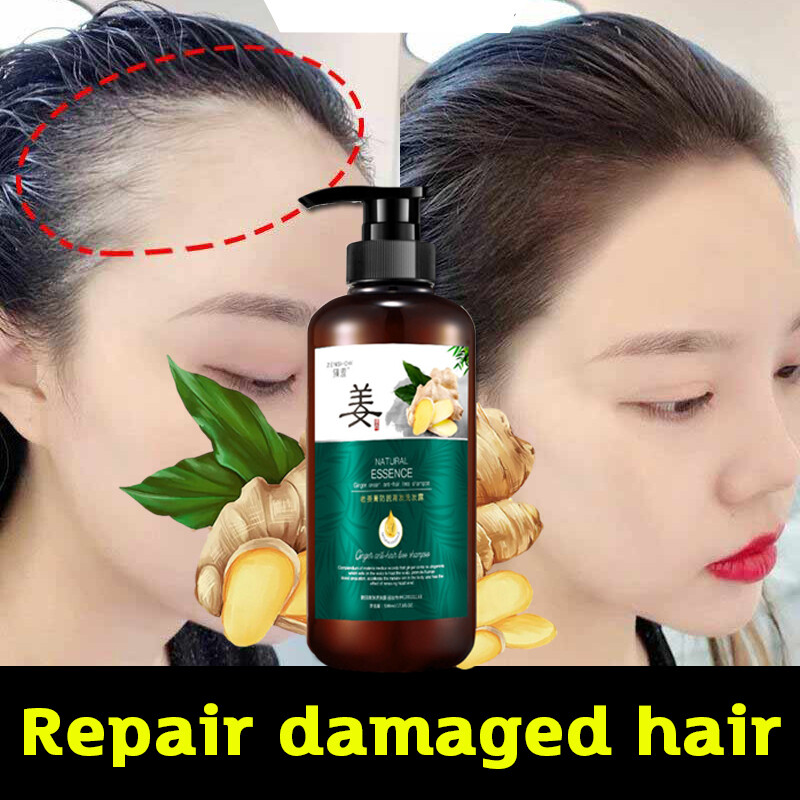Gambar Ginger Shampoo hair loss Ginger hair growth oil repair scalp anti dandruff cleansing shampoo anti dropping solid hair strong roots men and women nourishing hair anti hair loss shampoo syampu halia ?????