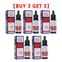 【Effective 3 days】Eelhoe Fungal Nail Repair Essence Foot Toe Nail Anti-Fungal Solution Anti Infection Paronychia Onychomycosis Removal Gel Nail Fungal Treatment Feet Care Serum(30ml/50ml)