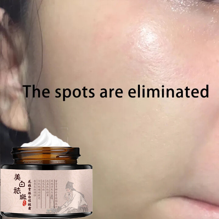 Gambar ?Shipped in Malaysia?Freckle Cream Removal Chloasma Spots Removes Melanin and Sooth Treatment Reduces Redness and Swelling Brightens Skin Tone Whitening Cream