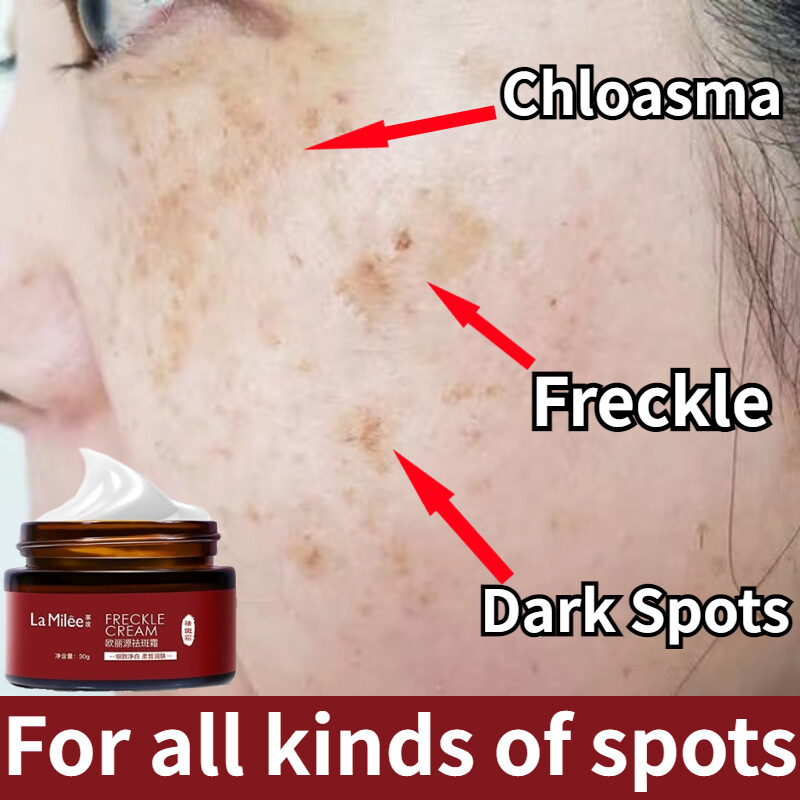 Gambar Freckle remover cream Krim jeragat paling berkesan whitening cream for face Dark spot remover Facial moisturizers Brightening skin cream Melasma removal cream