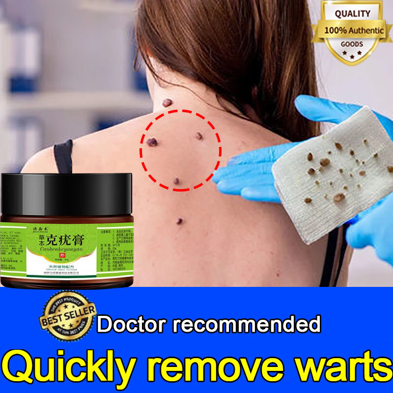 Gambar Wart Removal Ointment Fast Remove Skin Tag Remover Original Ointment Against Mole   Genital Wart Foot Corn Warts Papillomas Rapidly Removes Moles Cream Body Warts Removal Cream, Warts remover original Mole removal cream 20g